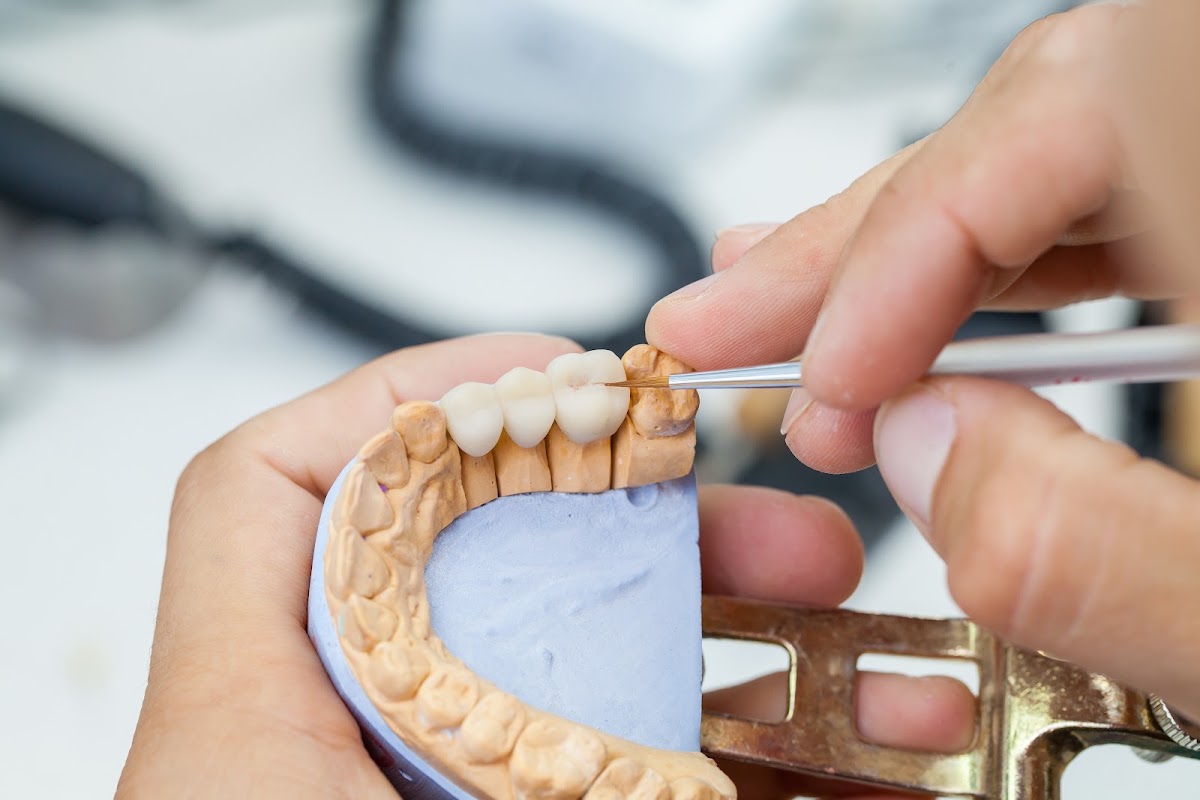 Frederick Street Dental Care I Oral Surgery Referral Centre — Dentist